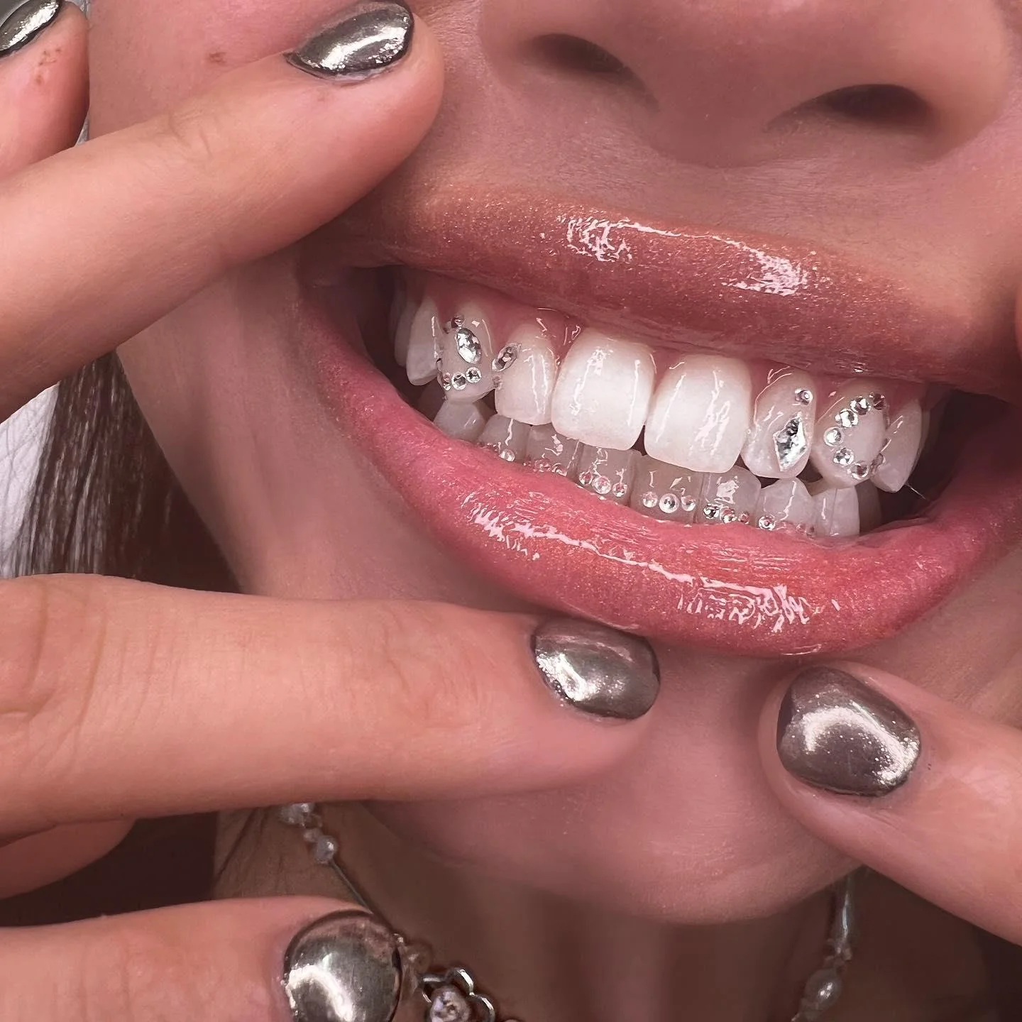 Joyería dental Grillz y Tooth Gens en Madrid Sur